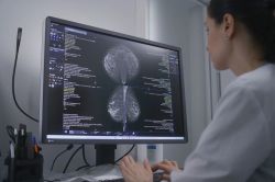 Screening oncologici, Azienda Zero punta sulla digitalizzazione: sistema operativo entro 36 mesi
