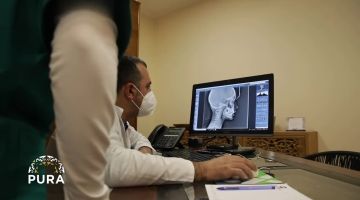 Pura - Le nuove tecniche per l'allineamento dentale  - Dott. Salvatore Sansalone