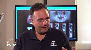 Pura - Dalla proiezione al risultato La chirurgia implantare che cambia il sorriso - Dott. Francesco Scandale